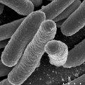Escherichia coli grossissement × 15 000